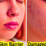 Signs of Healthy Skin